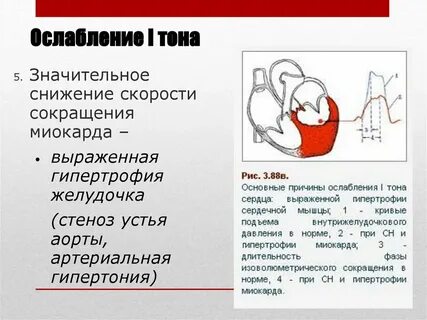 Тоны ясные