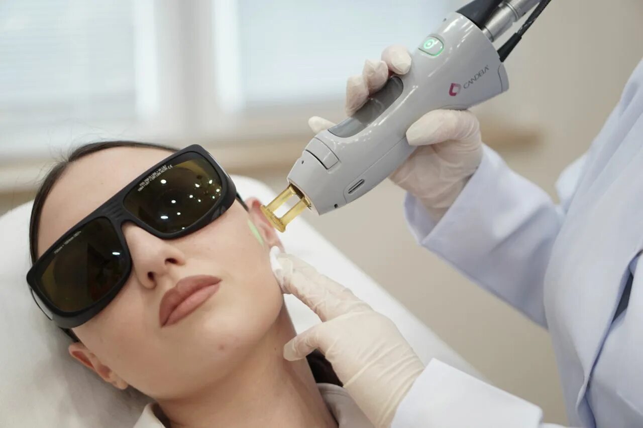 александритовый лазер кандела. лазерная эпиляция candela губа. александритовый лазер candela. александритовый лазер. александритовый лазер красноярск.