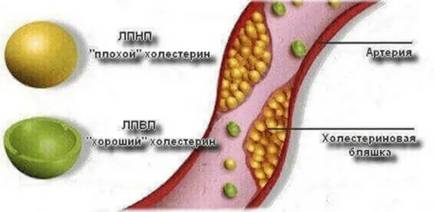 Липопротеиды низкой плотности у мужчин. Плохой холестерин. Хорошие липопротеиды. Липопротеины низкой плотности. Плохие липопротеины.