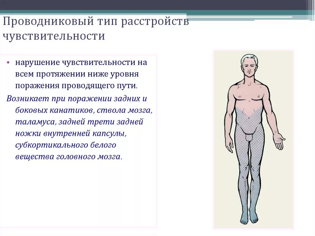 Нарушение проводниковой чувствительности