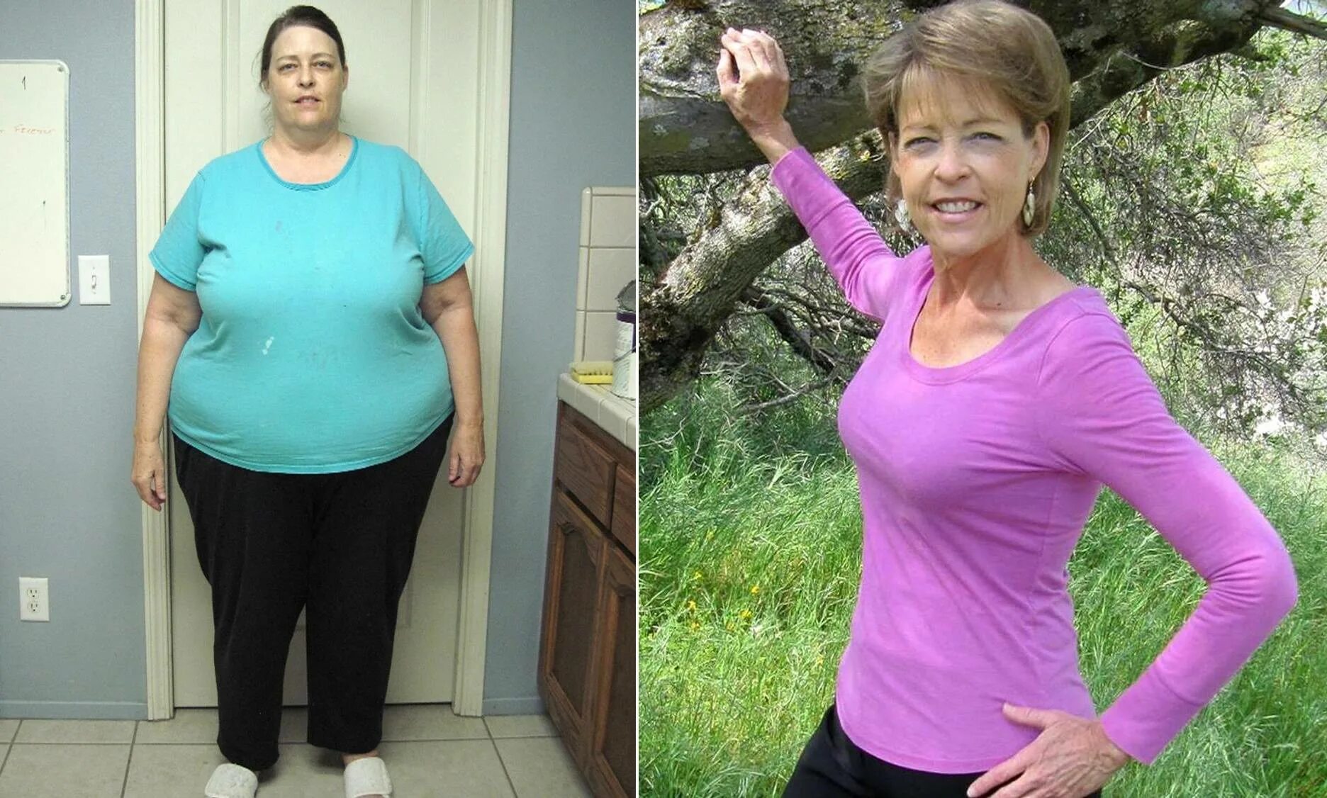 Похудение до и после. До и после похудения женщины. Похудение до и после фото. Похудение до после взрослые женщины.