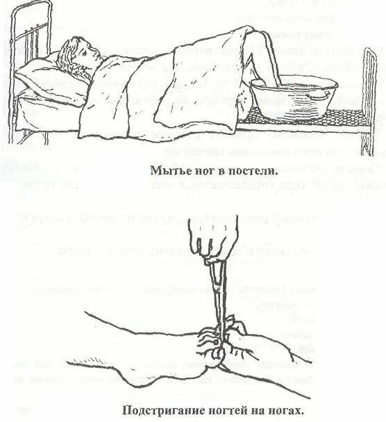 Мытье ног тяжелобольного пациента. Мытье тяжелобольного пациента в постели алгоритм. Мытье тяжелобольного пациента в постели. Мытье ног в постели тяжелобольному пациенту. Мытье тяжелобольных пациентов