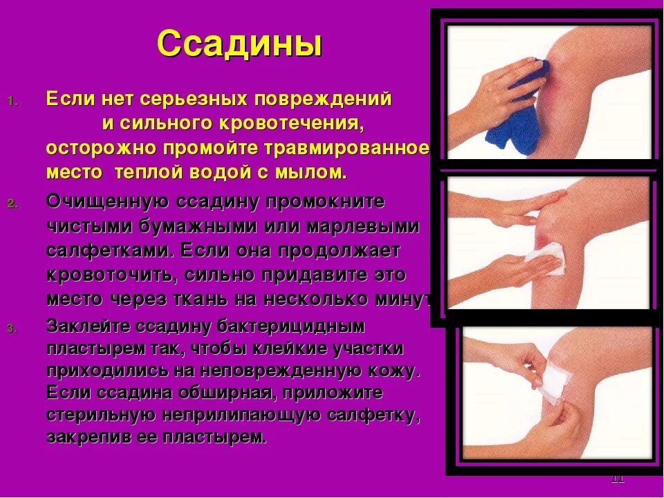 Помощь при царапинах. Первая помощь при ранах и ссадинах. оказание первой медицинской помощи при ссадинах. ушибы и ссадины первая помощь. ссадина первая помощь обж.