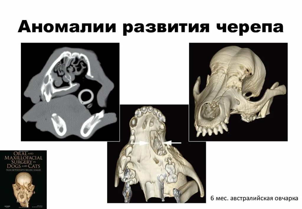 Черепная аномалия. Аномалии развития черепа. Аномалии развития лицевого черепа. Пороки развития костей черепа. Варианты аномалии и пороки развития черепа.