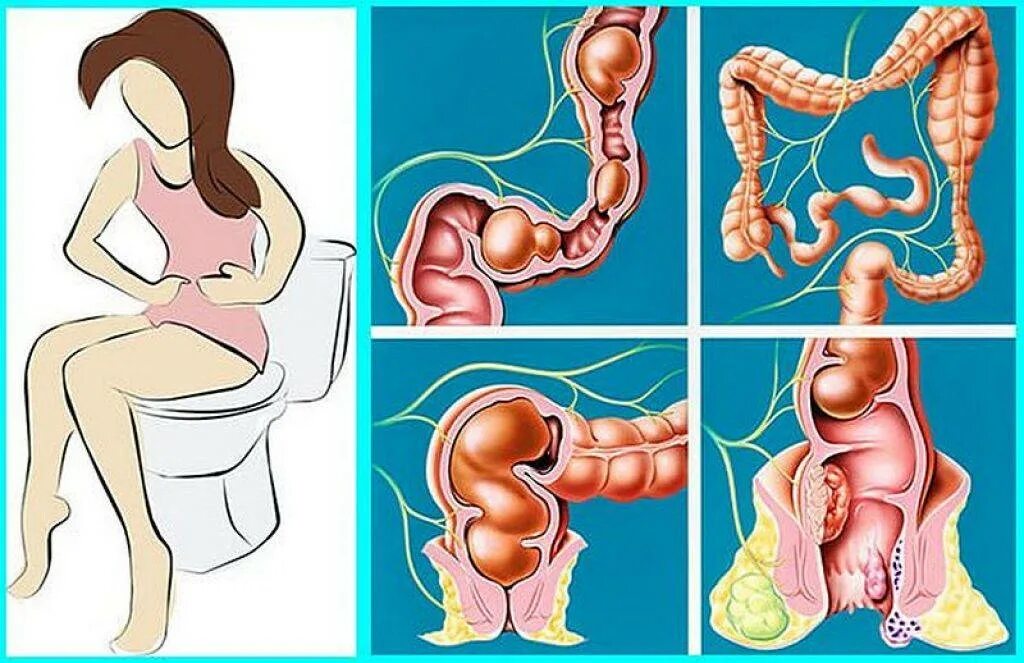 После дефекации женщинам и