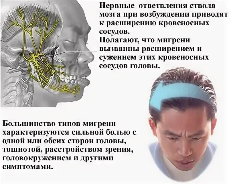 Больно шевелить глазами. Головная боль мигрень. Типы головной боли. Мигрень симптомы. Болит голова в лобной и затылочной части.