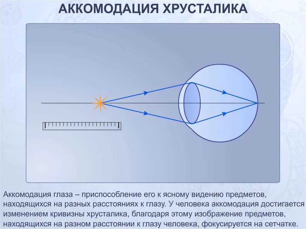 Аккомодация структуры. Схема аккомодации хрусталика. Аккомодационные структуры глаза. Оптическая система глаза аккомодация. Схема преломления лучей хрусталиком глаза.