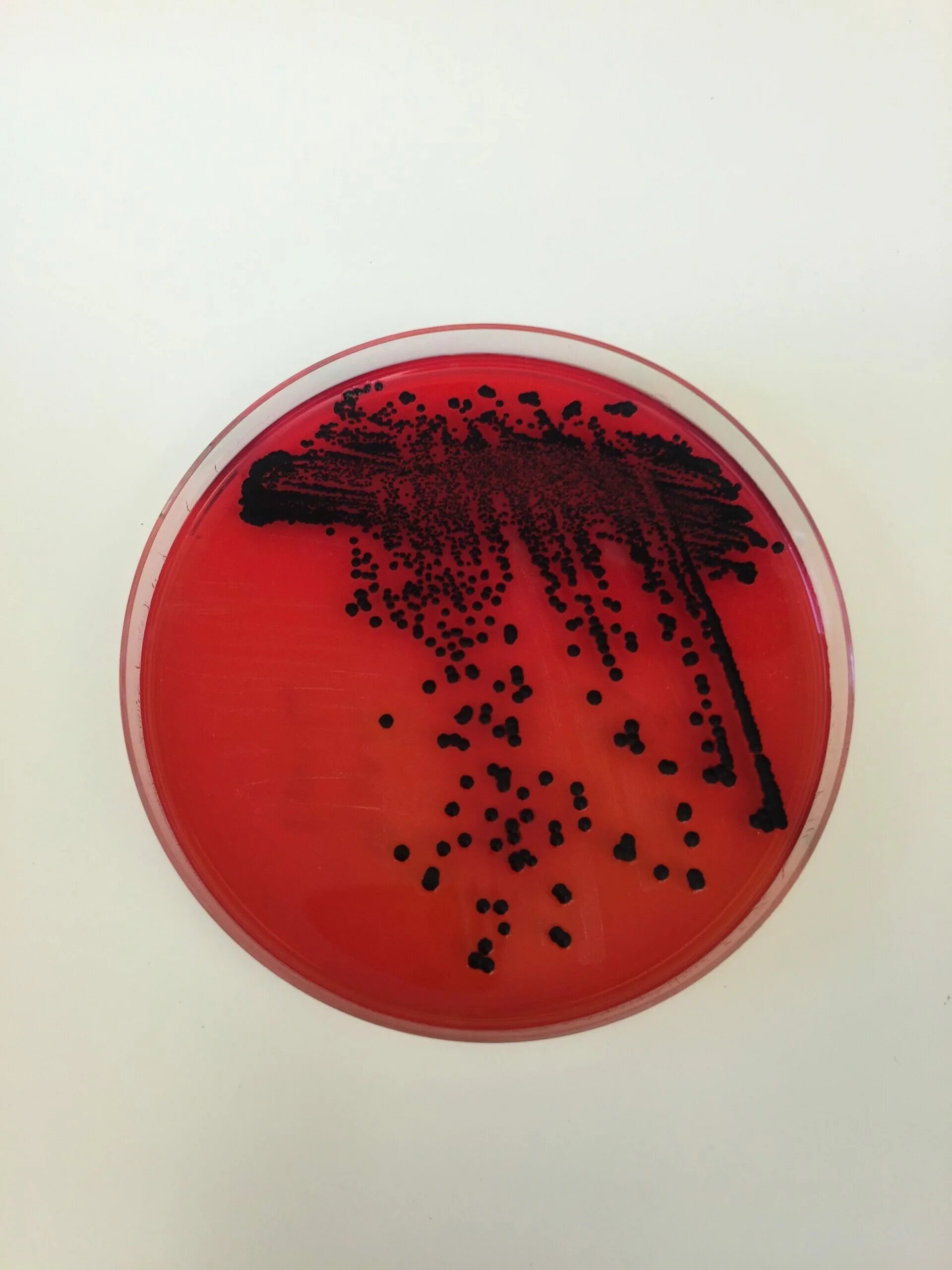 Salmonella typhi микробиология. Бактерия сальмонелла Тифи. Salmonella typhi на среде. Salmonella Typhimurium микробиология. Посев на сальмонеллез