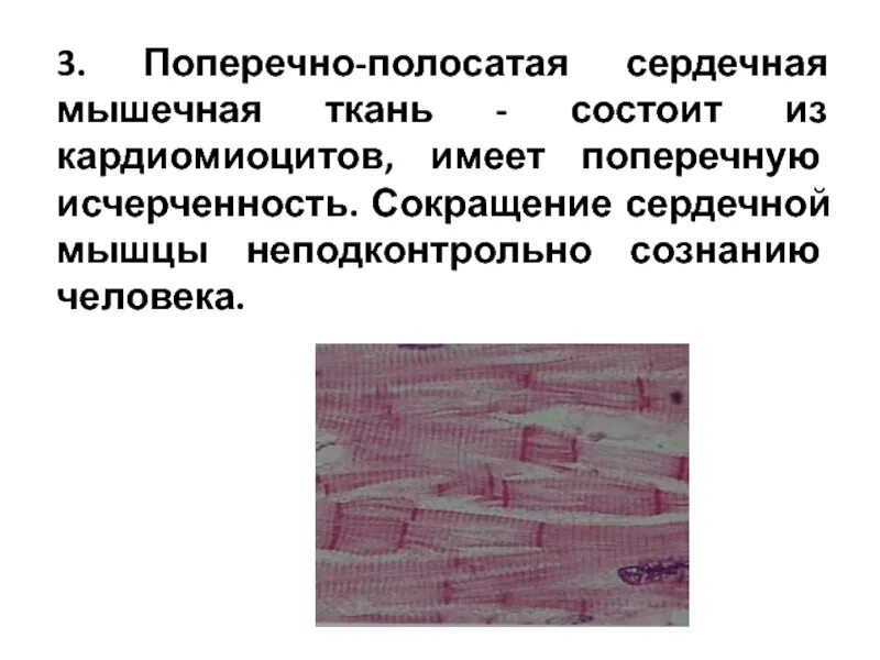 Состоит из клеток имеющих поперечную исчерченность. Поперечнополосатая сердечная мышечная ткань. Сердечная мышечная ткань исчерченность. Поперечно полосатая мышечная ткань ткань. Поперечная исчерченность в сердечной мышечной ткани.