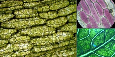 растительная клетка под микроскопом