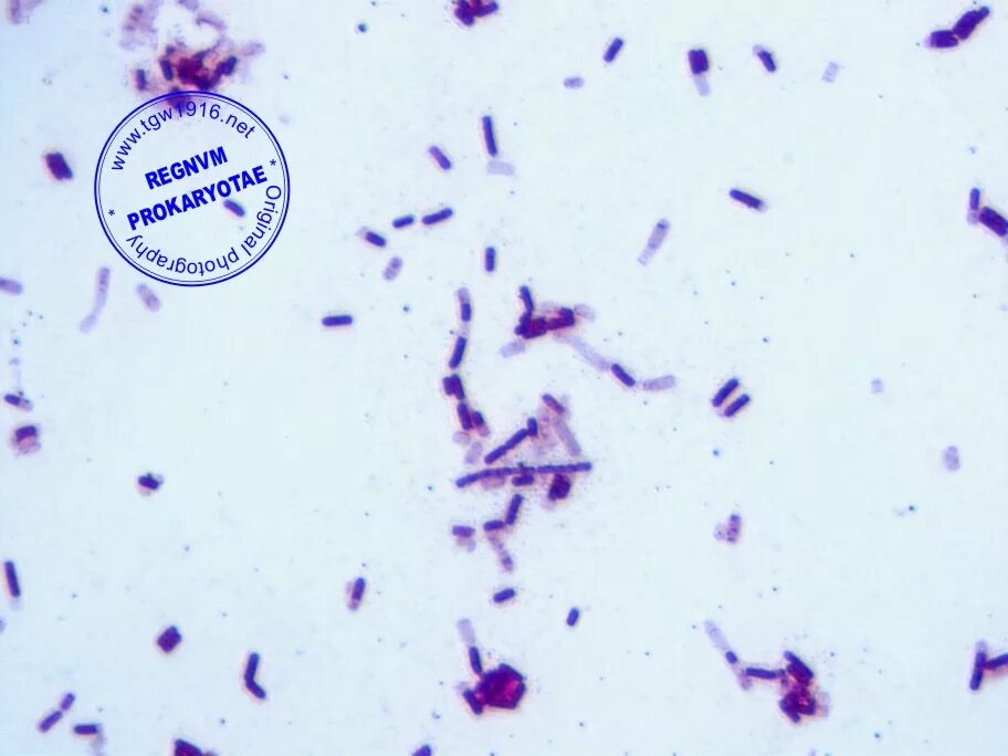 Лактобациллы по Граму l. Acidophilus. Лактобациллы в мазке. • Lactobacillus Acidophilus на питательной среде. Микроскопия закваски l.Acidophilus.