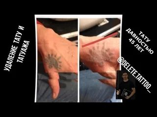 Можно пить после сеанса тату. Сколько длится сеанс тату. что нельзя делать перед тату сеансом. самый долгий сеанс тату. не должен тату.