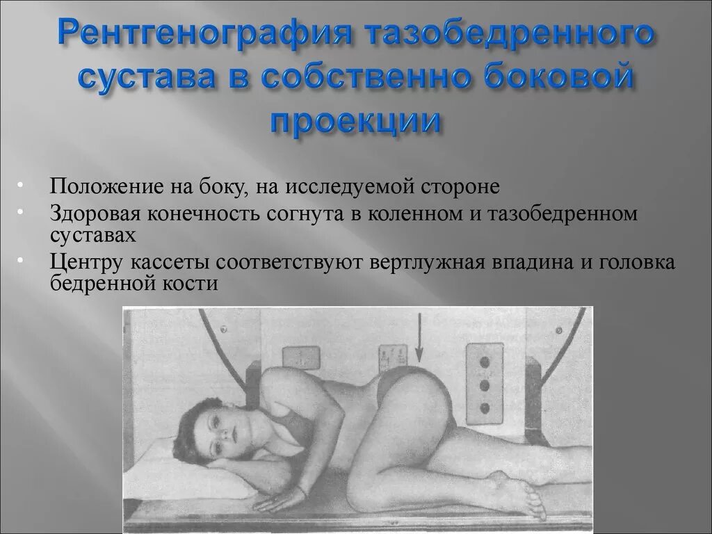 Проекции рентгена тазобедренного сустава. Тазобедренный сустав рентген укладка. укладка для рентгенографии тазобедренного сустава. тазобедренный сустав прямая проекция. укладка для рентгенограммы тазобедренного сустава.