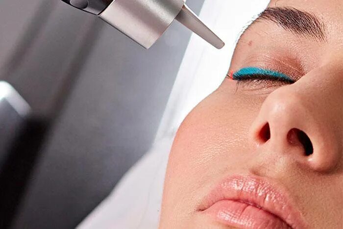 Удалить перманентный макияж. Перманентный макияж. Удаление перманентного макияжа лазером. Лазер брови. Удалить перманентный макияж.