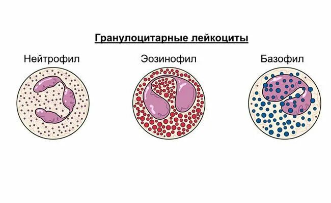 Повышенные гранулоциты в крови у мужчин. Гранулоциты и агранулоциты. Зернистые лейкоциты гранулоциты. Лейкоциты гранулоциты и агранулоциты. Гранулоцитопения симптомы.