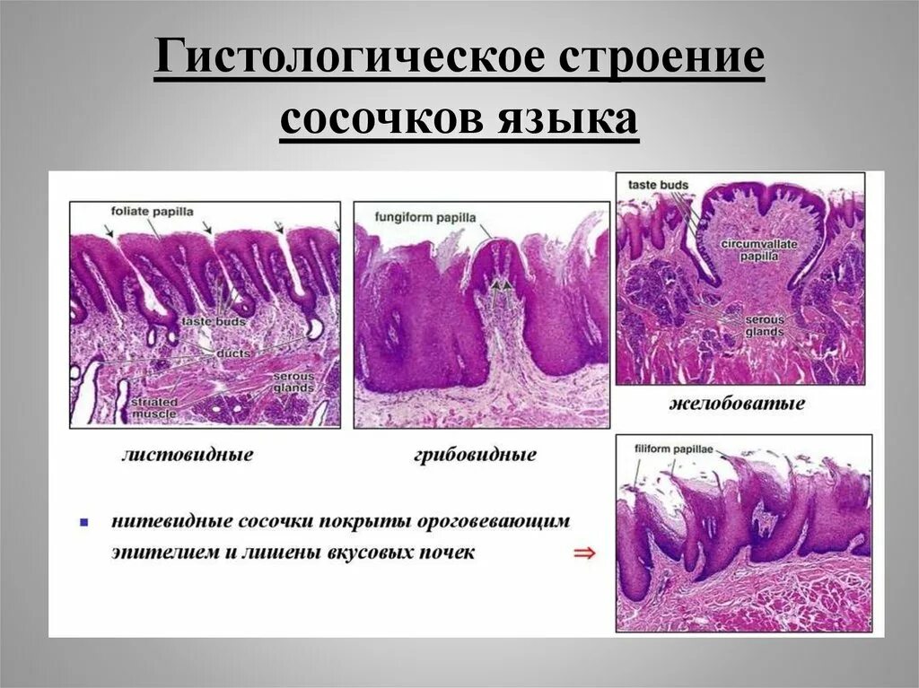 Листовидный сосочек языка гистология препарат. Листовидные сосочки гистология строение. Вкусовые почки (листовидные сосочки языка). Вкусовые почки в листовидных сосочках языка гистология.