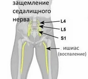 Нерв в паху