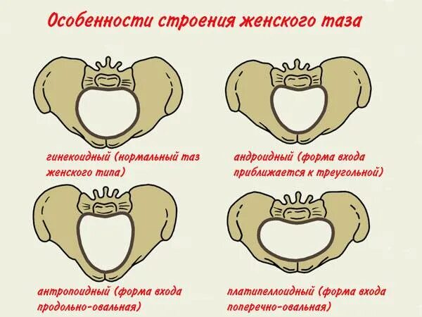 Формы женского таза. Типы строения таза. Расширение таза при беременности