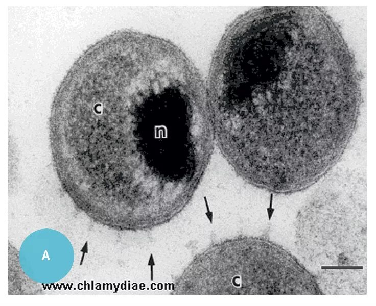 Хламидии под микроскопом. Элементарные и ретикулярные тельца хламидий. Этиология хламидийных инфекций. Хламидий результат