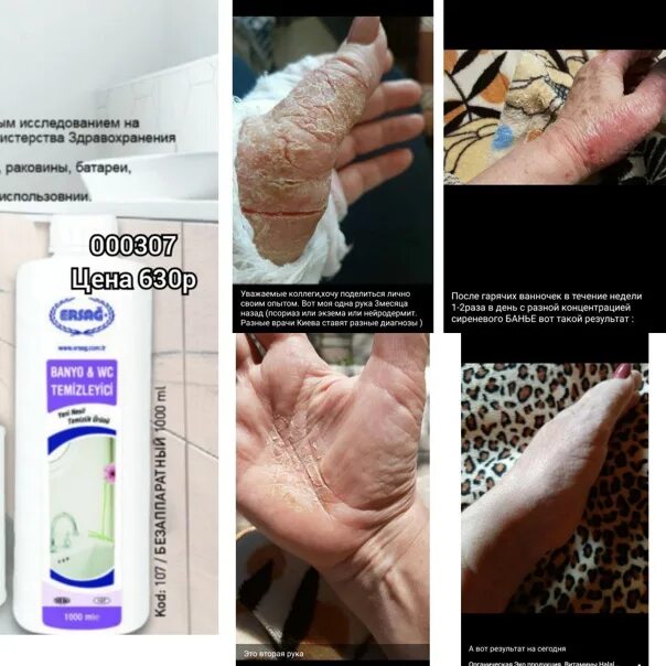 Clean ball крем masaj kremi. Гель с сосновой корой эрсаг. Ersag массажный крем эрсаг 200 мл. Эрсаг крем от псориаза. Ersag массажный крем 200мл.