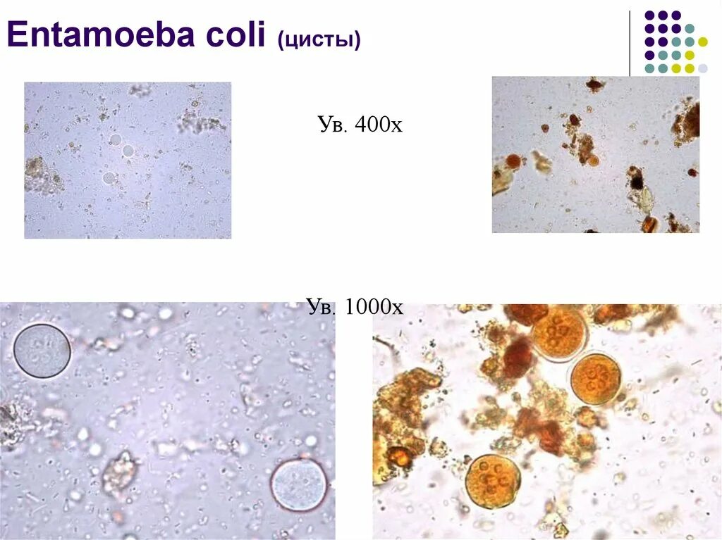 Entamoeba coli циста строение. Цисты лямблий микроскопия кала. Entamoeba coli в Кале. Простейшие в кале лечение