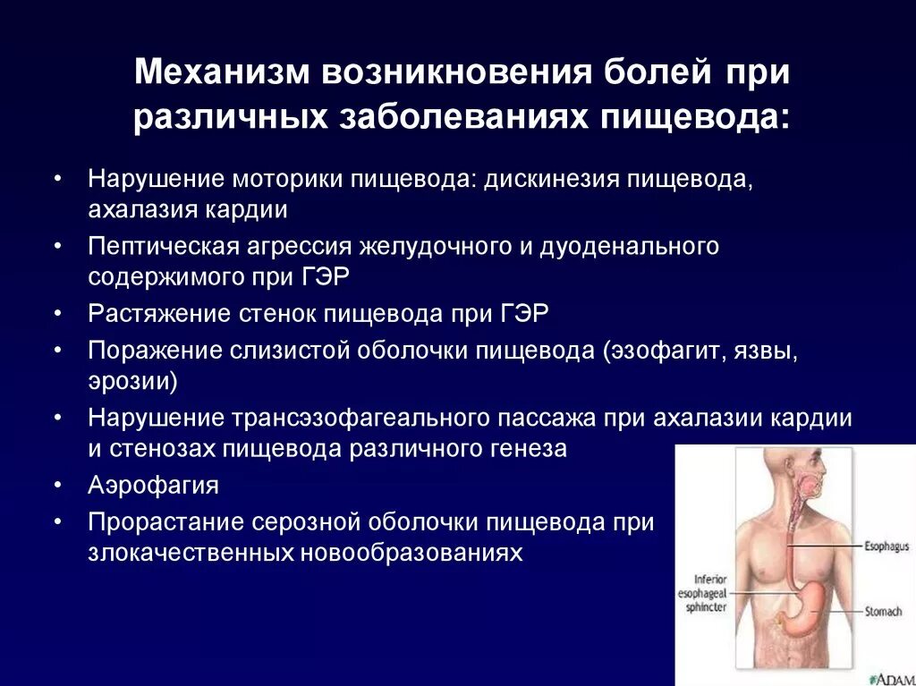 Нарушение перистальтики пищевода. Симптомы при заболеваниях пищевода. Основные заболевания пищевода. Боли по ходу пищевода