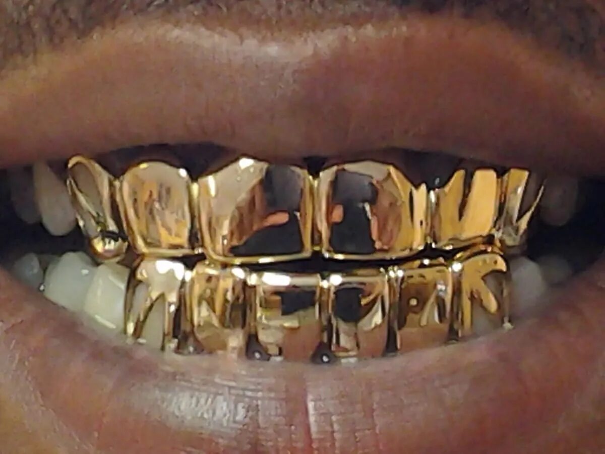 Сколько стоит металлические зубы. Металлическая коронка. Золотые зубные коронки.