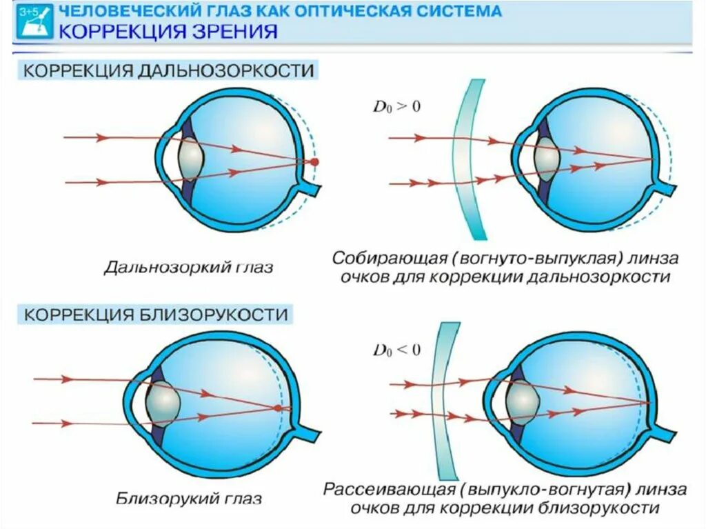 2 25 какое зрение. Строение глаза дальнозоркость с линзой. Коррекцию дальнозоркости проводят с помощью линз. Оптика глаза схема аккомодация. Линзы дальнозоркость и астигматизм.