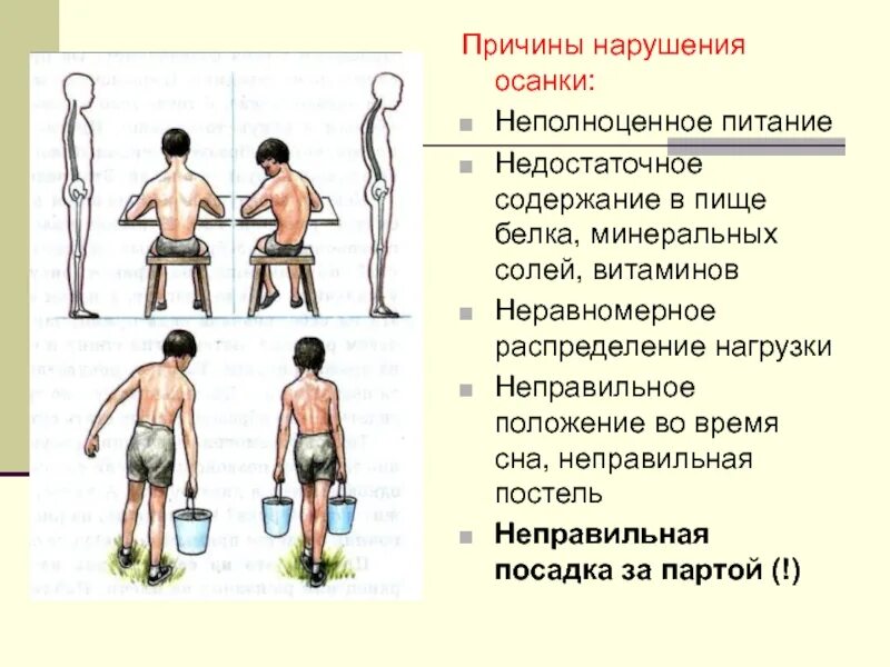 Основные нарушение осанки