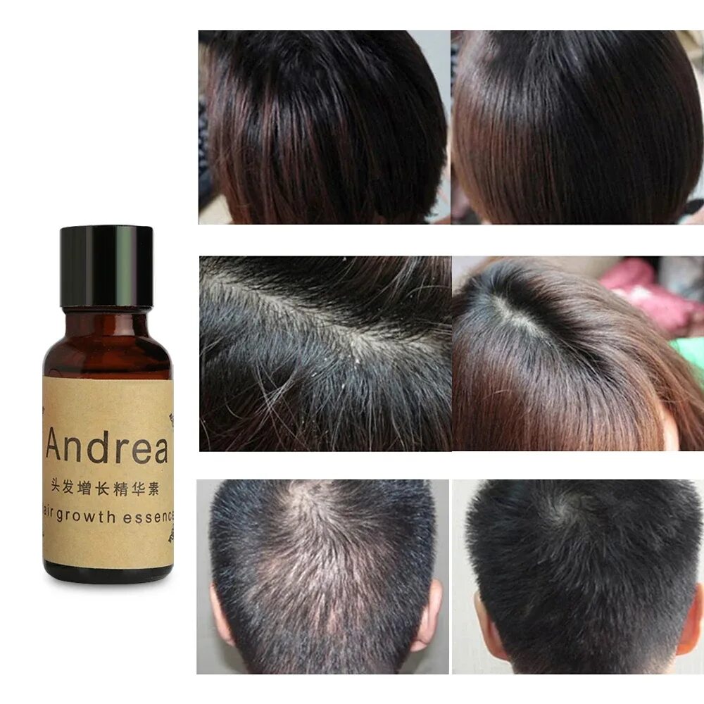 Andrea hair growth Essence. Сыворотка Андреа для роста волос. Сыворотка hyoing hair growth Essence. Средство для роста волос на голове. Масло растут волосы