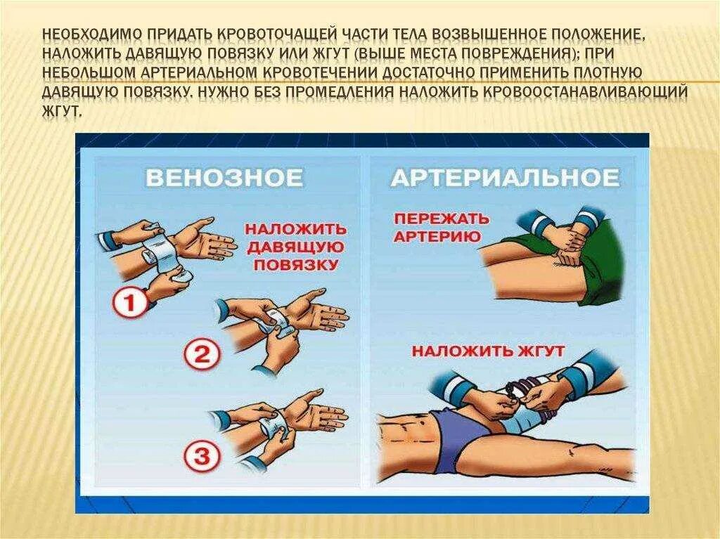 Экстренная помощь при кровотечениях. Оказание первой помощи при кровотечении. Наложение повязки при венозном и артериальном кровотечении. Наложение жгута для остановки кровотечения. Наложение жгута и давящей повязки.