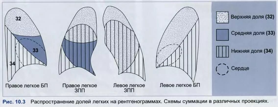 Доли легкого на рентгенограмме. Проекция долей легкого на прямой и боковой рентгенограмме. Сегмент s3 правого легкого располагается. Долевое строение легких схема. Схема долевого строения легких в прямой проекции.