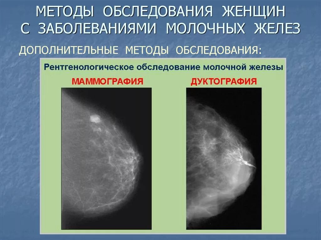 Шишка в грудной железе у женщин. Болезни молочной железы. Обследование молочных желез. Патология молочных желез. Методы обследования молочных желез.