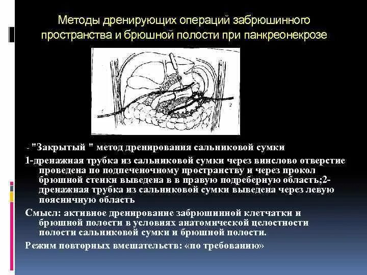 Методы дренирования сальниковой сумки. Абсцесс брюшной полости операция. Трансгастральное дренирование парапанкреатической кисты это. Методы дренирующих операций при панкреонекрозе. Абдоминальная операция что это