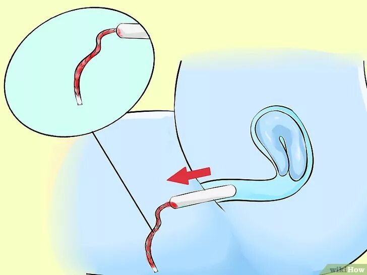 как вставлять тампон картинки. можно писать с тампоном внутри. как вставить тампоны первый раз. можно писать с тампоном внутри. можно писать с тампоном внутри.