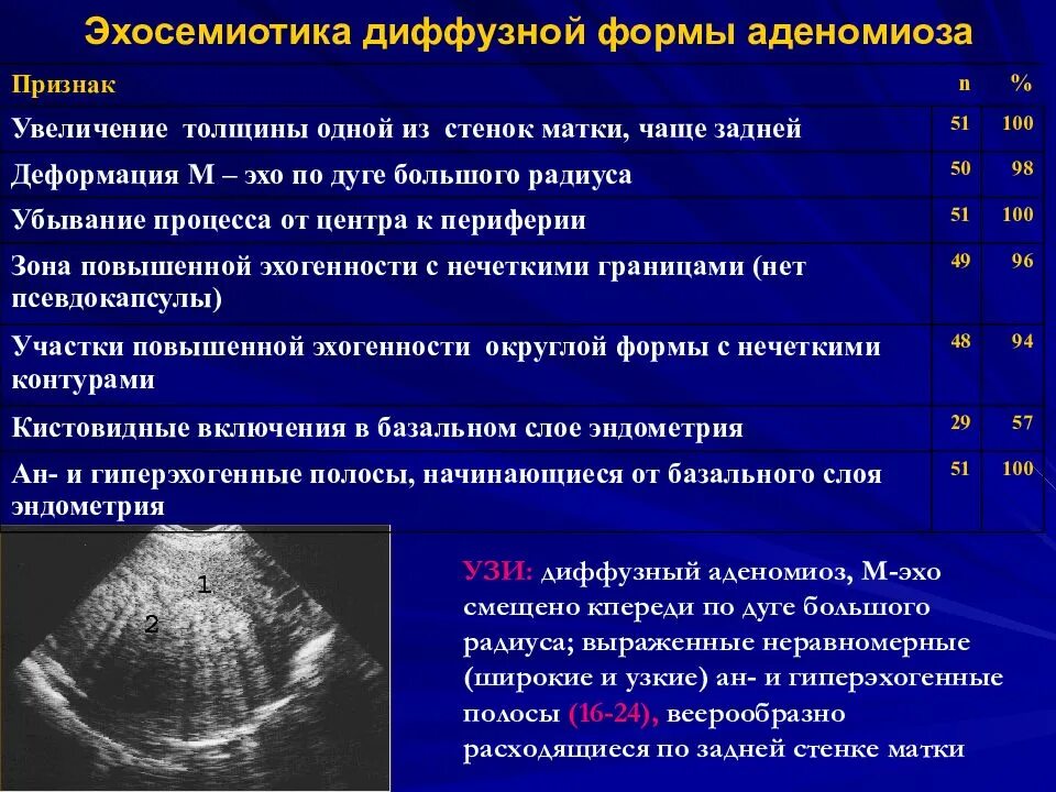 Диффузные л. Аденомиоз 1 степени диффузная форма. Критерии аденомиоза на УЗИ. Диффузный эндометриоз матки УЗИ. Диффузная форма аденомиоза УЗИ.