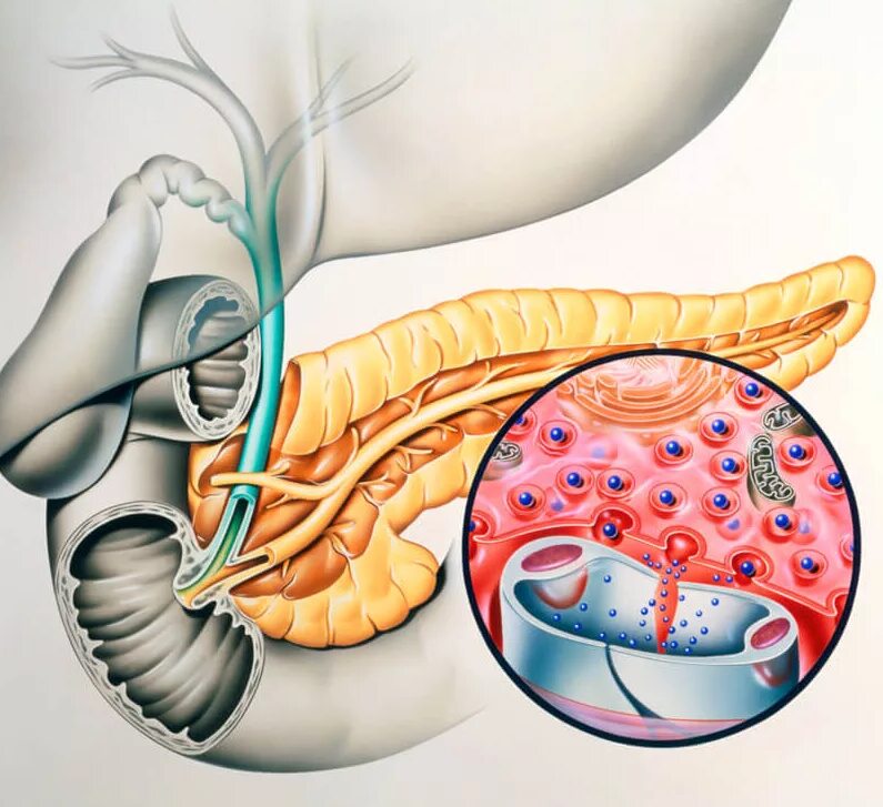 Панкреатит поджелудочной железы. Парапанкреатическая клетчатка поджелудочной железы. Железа вырабатывающая гормон инсулин. Панкреатит ноги