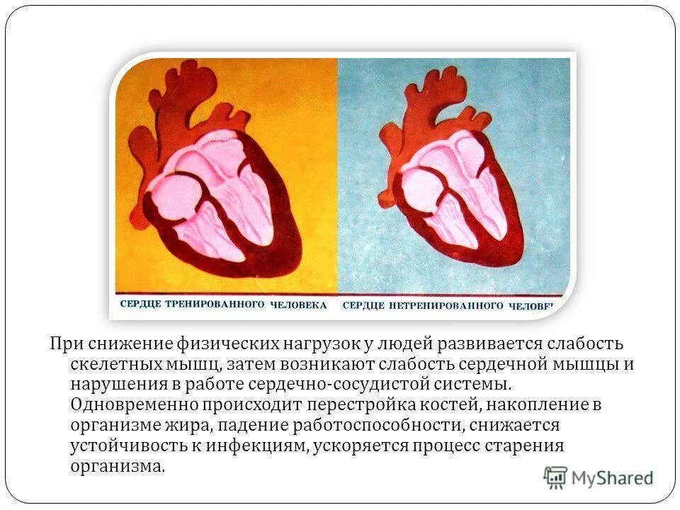 Тренированность сердца. Сердце тренированного и нетренированного. Сердце тренированных людей. Сердце нетренированного человека. Тренировка периферических сердец.