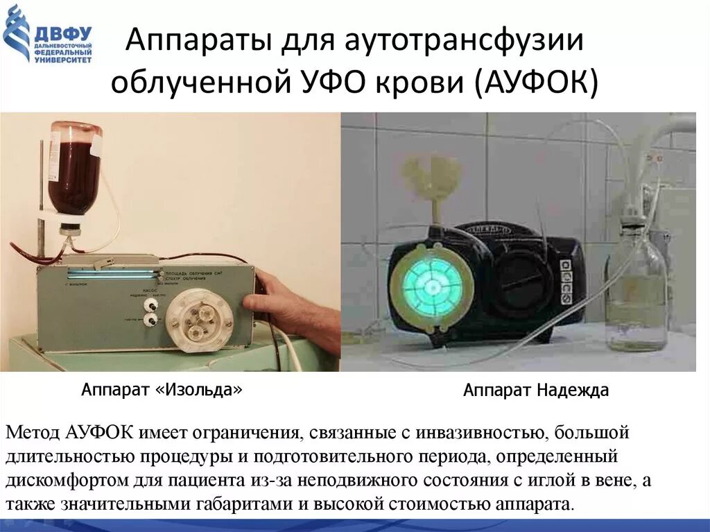 Уфо метод. Уфо метод