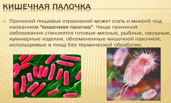 Escherichia coli что это у мужчин. Серотипы кишечной палочки. Кишечная палочка Микра. Кишечная палочка анаэроб. Бактерии группы кишечной палочки.