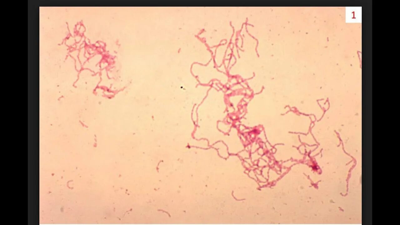 Haemophilus в мазке у мужчин. Haemophilus ducreyi под микроскопом. Бактерия Haemophilus ducreyi (палочка Дюкрея).