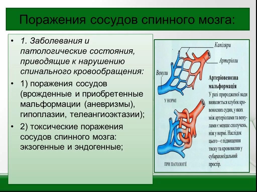 Сосудистые поражения мозга. Сосудистые поражения спинного мозга. Расстройство спинального кровообращения. Заболевания сосудов спинного мозга. Острое нарушение спинального кровообращения.