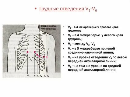Второе межреберье справа от грудины