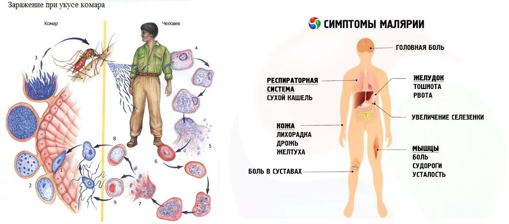 Симптомы болезни малярийного плазмодия. Малярия патогенез и клиническая картина. Малярийный плазмодий симптомы. Малярийный плазмодий признаки заболевания. Заражение человека малярией происходит