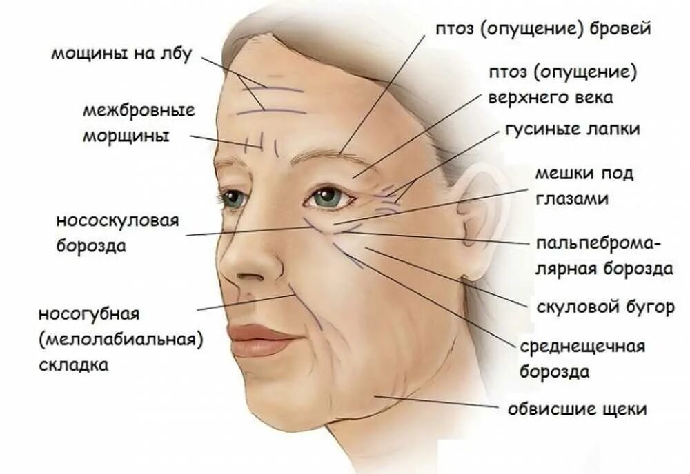 Височные морщины. Гравитационные морщины. Схема морщин на лице. Название морщин на лице схема.