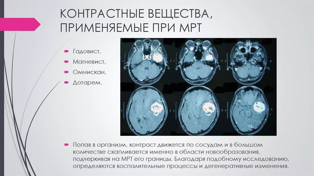 Зачем назначают мрт. Контрастное вещество, применяющиеся при мрт?. Вещества при мрт. Ввод контрастного вещества при мрт. Компьютерная томография с контрастным веществом.