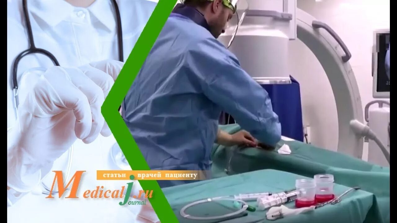 Операция эма после