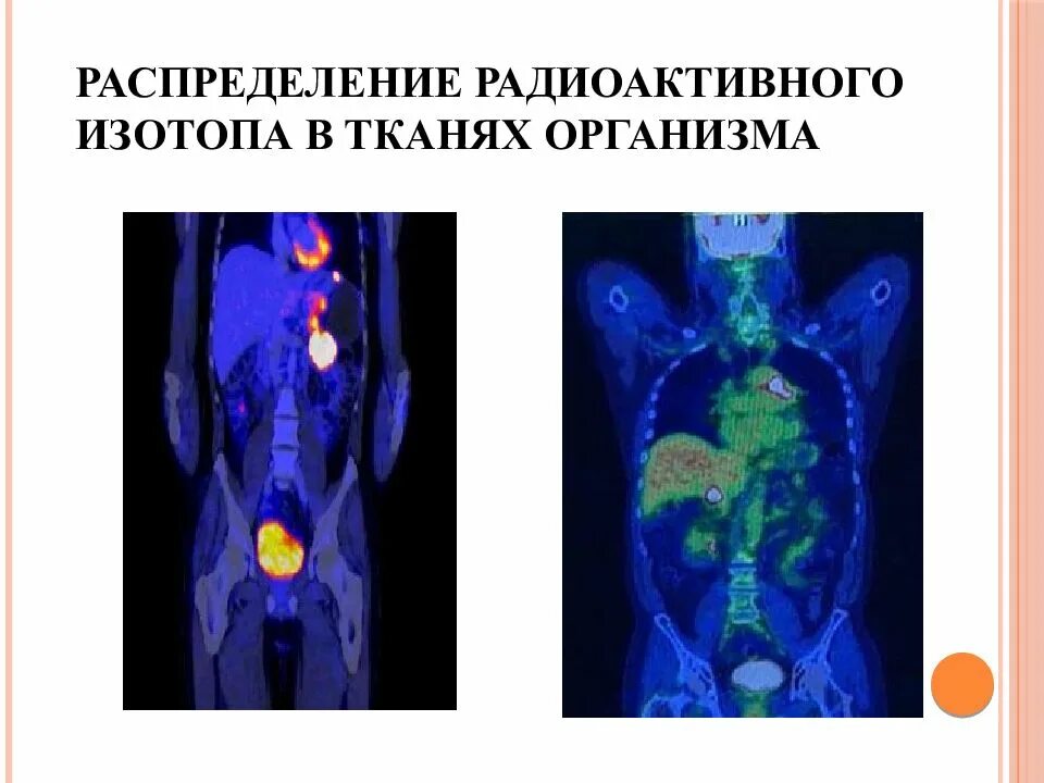 Исследование изотопами. Введение изотопов в организм. Введение в организм радиоактивных изотопов. Метод радиоактивных изотопов. Радиоактивная метка в биологии.