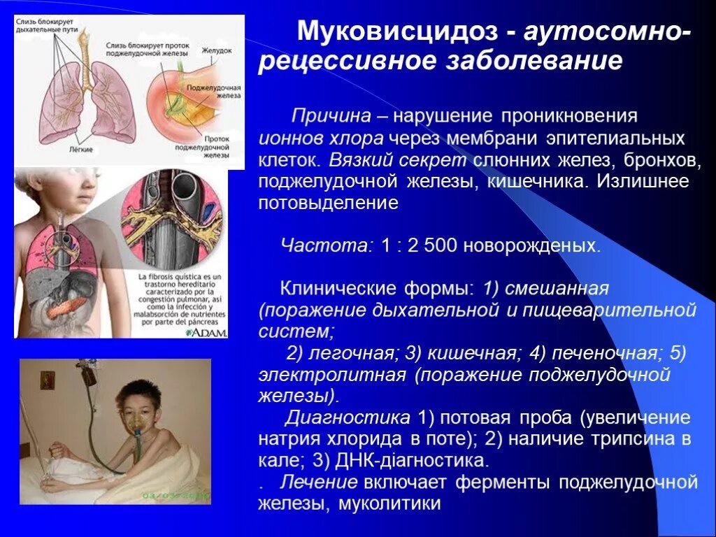 Болезнь полученный диагноз. Генетическое заболевание муковисцидоз. Наследственное заболевание муковисцидоз.