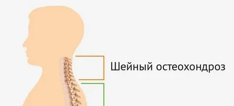 Демченко остеохондроз